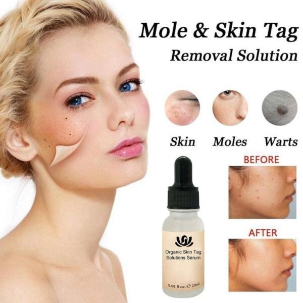 Organic Tags Solutions Serum Skinless Mole Skin Un Painless Mole Skin សេរ៉ូមបំបាត់ស្នាមអុចខ្មៅលើផ្ទៃមុខ បំបាត់អាចម៍រុយ 1