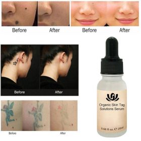 Mole Removal Serum - image 5