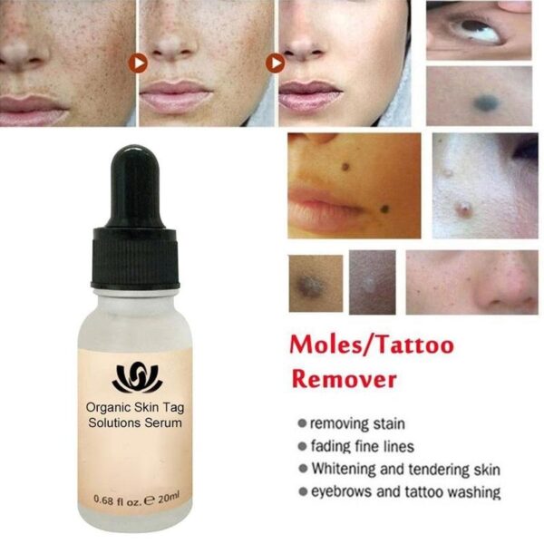 Organic Tags Solutions Seramu Yopanda Ululu Mole Khungu Lakuda Malo Kuchotsa Serum Nkhope ya Njereta Tag Kuchotsa Freckle 5