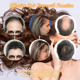 Hair Regrowth Essence Intensive Spray - image 7