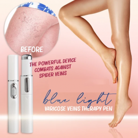 Blue Light Therapy Varicose Veins Pen - image 1
