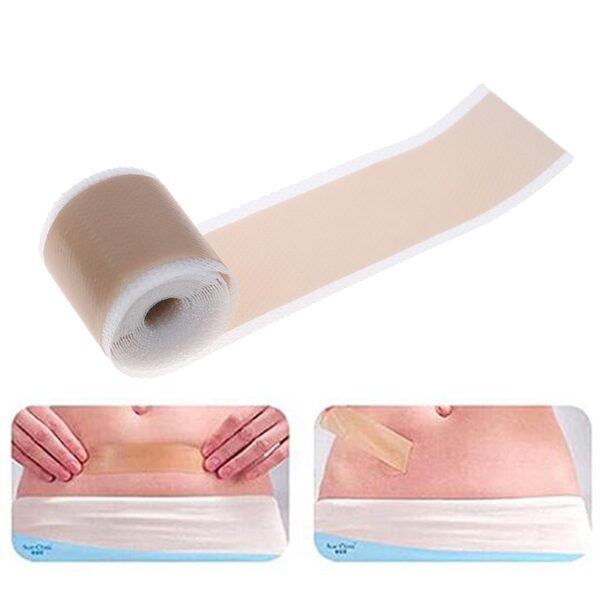 4x150cm 3 5x12cm ʻO ka ʻoki ʻoki ʻana i ka maʻi maʻi maʻi Silicone Gel Sheet Therapy Patch for Acne Trauma Burn 2