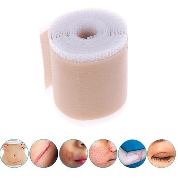 4x150cm 3 5x12cm Efficient Surgery Scar Removal Silicone Gel Sheet Therapy Patch for Acne Trauma Burn 3