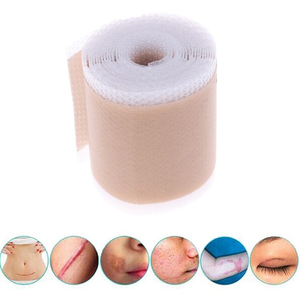 4x150cm 3 5x12cm ʻO ka ʻoki ʻoki ʻana i ka maʻi maʻi maʻi Silicone Gel Sheet Therapy Patch for Acne Trauma Burn 3