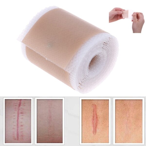 4x150cm 3 5x12cm Opereishene e Sebetsang ka ho Fetisisa Ho Tlosa Silicone Gel Sheet Therapy Patch for Acne Trauma Burn