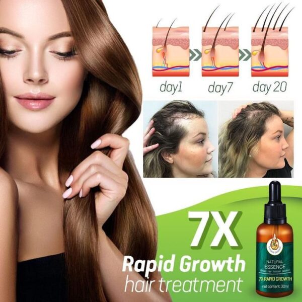 1pc 7X Rapid Growth Hair Treatment Anti Hair Loss Fast Hair Growth Serum Ginger Essential Oil