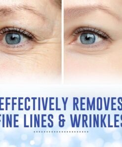 100620 WrinkleRemoverMicroneedleEyeMask shynne graphic6 590x