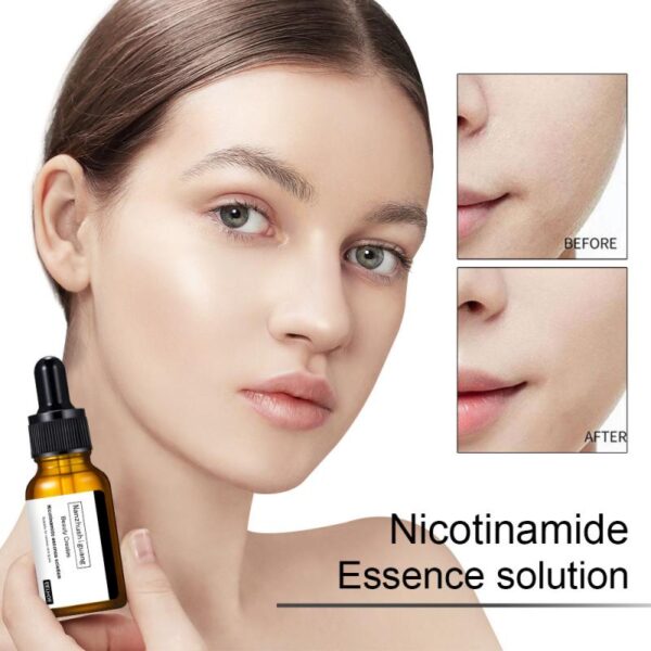 Uudet niacinamide Single Nucleotide Essence -kosteuttavat pilkulliset kutistehuokoset valkaisevat kirkastavat ihon Essence-ihonhoitosetit 1