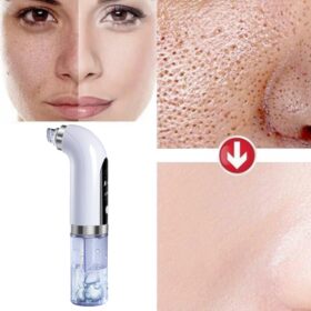 Rechargeable Blackhead Remover - image 4