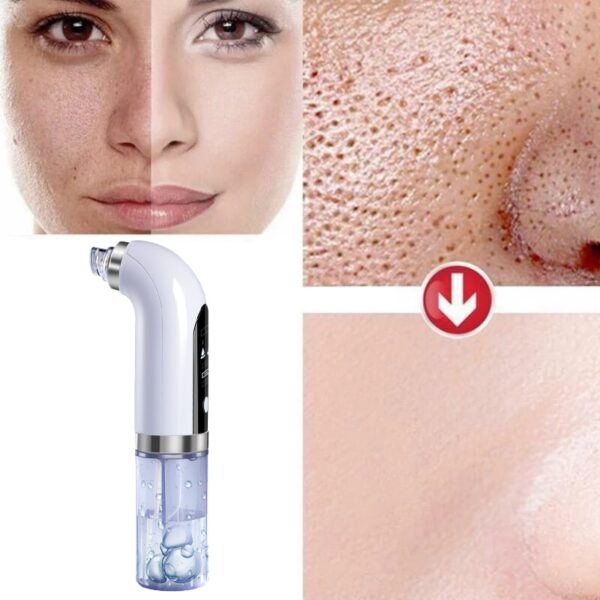 Blackhead Remover Pore Vacuum Cleaner Upgraded Blackhead Vacuum Rechargeable Face Vacuum Comedone Extractor Tool for Blackhead 2