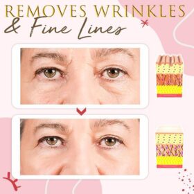 Snails Skin Care Eye Massage Cream - image 2