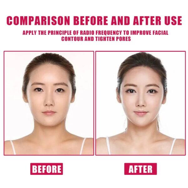 30ml V Shaped Face Slimming Oil Enzyme Face Lift Essential Oil Removing Double Chin Burning Fat 2