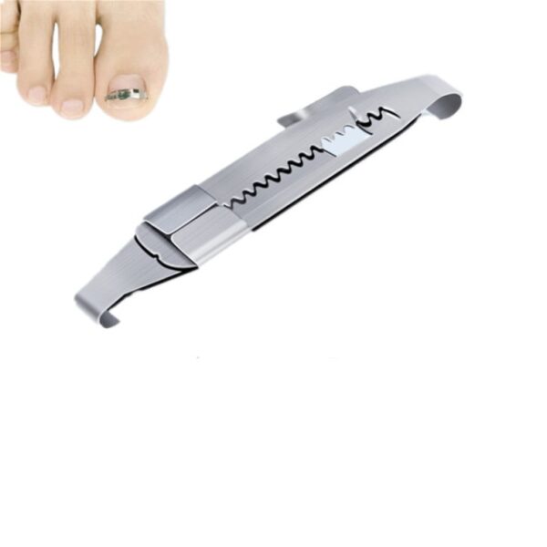 Korektor uraslog nokta Alati Pedikir za oporavak ugrađeni nožni nokat Profesionalni tretman korekcije uraslog nokta Njega stopala 1.jpg 640x640 1