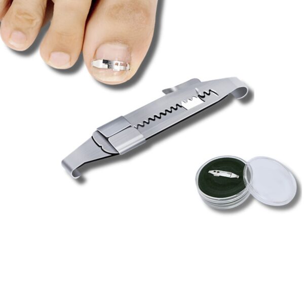 Ingrown toenail corrector Tools Pedicure Recover Embed Toe Nail Treatment professional Ingrown toenail corrector Foot Care 2