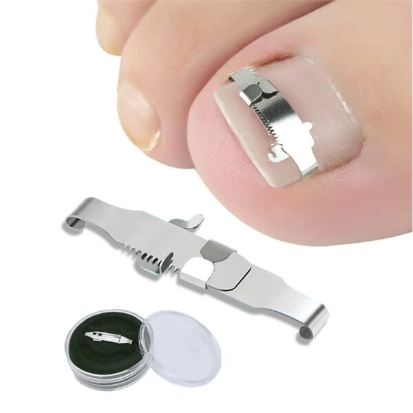 Ingrown toenail corrector Tools Pedicure Recover Upota varpaiden kynsien hoito ammattilainen Sisään kasvanut varpaankynsien korjaus