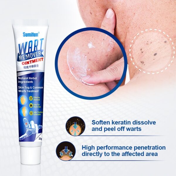 Sumifun Warts Remover Antibacterial Marashi Tiba ya Vidonda Cream Ngozi Tag Remover Herbal Extract Corn Plaster Warts 4