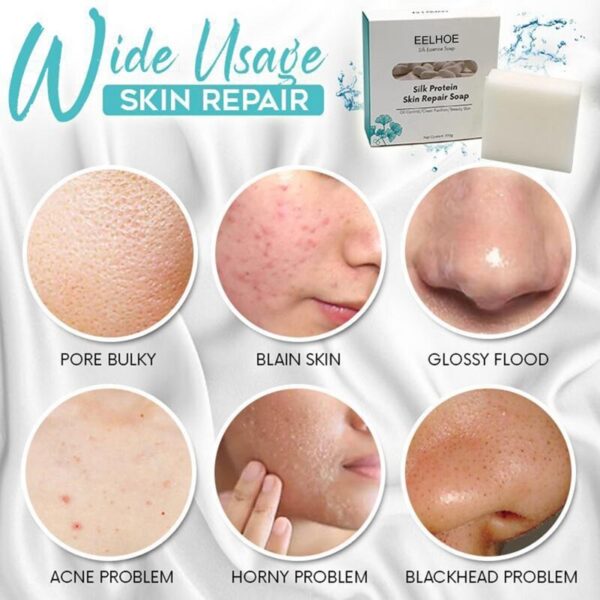 100g Silk Protein Skin Repair Facial Cleaning Soap Remove Mites Blackheads Handmade Soap Oil Control Bath 2