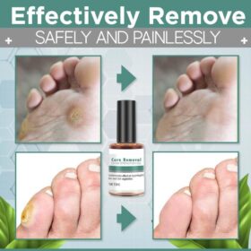 Corn Removal Extra Strengthen Gel - image 6