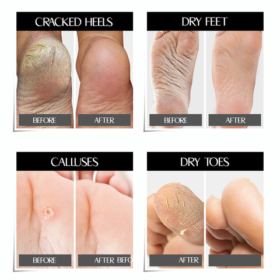 Goat Milk Exfoliating Nourishing Foot Masks - image 8