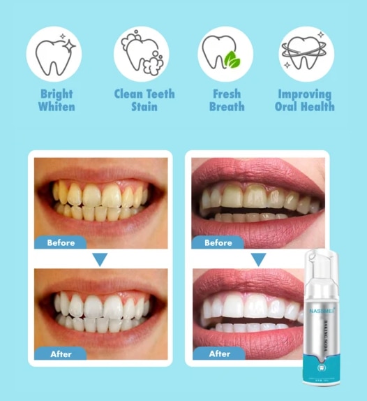 Baking Soda Teeth Whitening Fluoride free Mousse Foam Toothpaste Deep Clean Hygiene Stain Removal Fight Bleeding 3