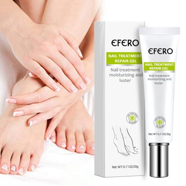 Pieds d'orteils fongiques du traitement des champignons des ongles Anti-Infection fongique pied Anti-inflammatoire Onychomycose ongle d'orteil 5