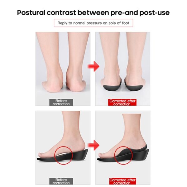 Orthotics Unisex Flatfoot TPR Insole meud mòr airson casan còmhnard cumadh O O Taic Bogha Plantar 4