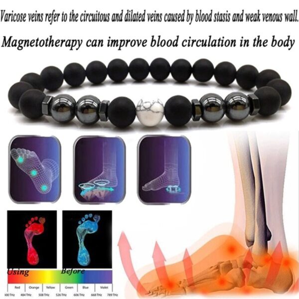 Magnet Anklet Colorful Stone eight Loss Magnetic Therapy Bracelet Weight Loss Product Slimming Health Care jewelry 5