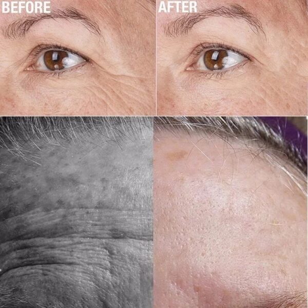 Wrinkle Silicone in-athúsáidte Bain Greamán Facial Forehead Muineál Greamán Súl Pad Frith-Wrinkle Aosú Ardú Craicinn 4