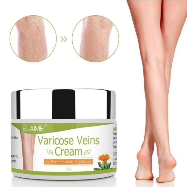 Varicose Veins Ointment 50g Varicosity Angiitis Removal Medical Plaster Vasculitis Phlebitis Spider Cream 1