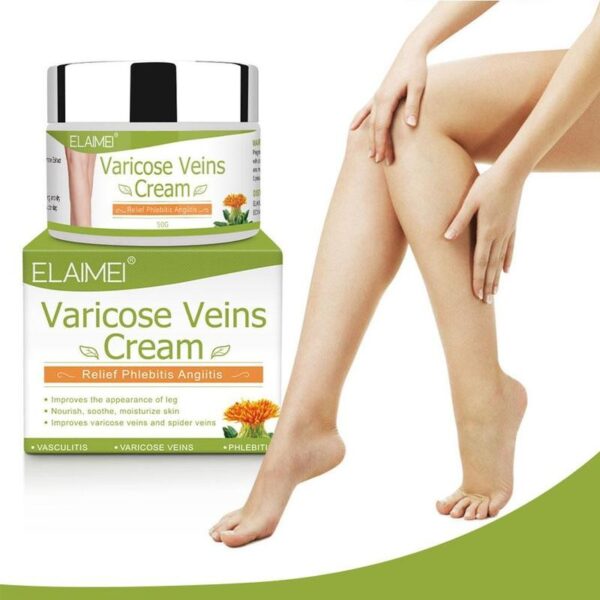 Varicose Veins Ointment 50g Varicosity Angiitis Removal Medical Plaster Vasculitis Phlebitis Spider Cream 2