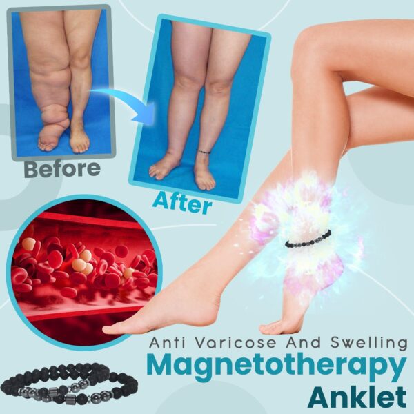 anti varicose and swelling magnetotherapy anklet 1688