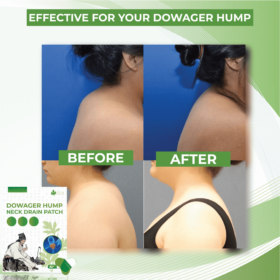 DowagerHump NeckDrain Patch - image 3