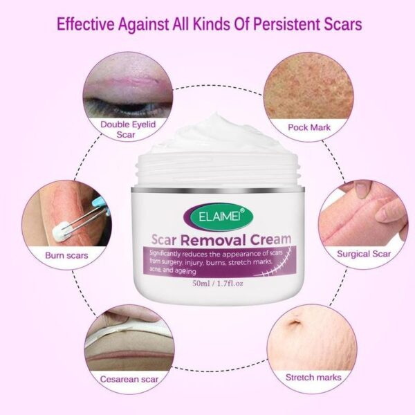Skin Rebound Scarless Cream Scar Removal Cream Face Cream For Face Acne Scar Stretch Marks Skin 10