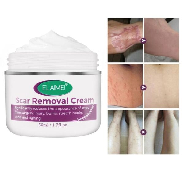 Skin Rebound Scarless Cream Scar Removal Cream Face Cream For Face Acne Scar Stretch Marks Skin 8