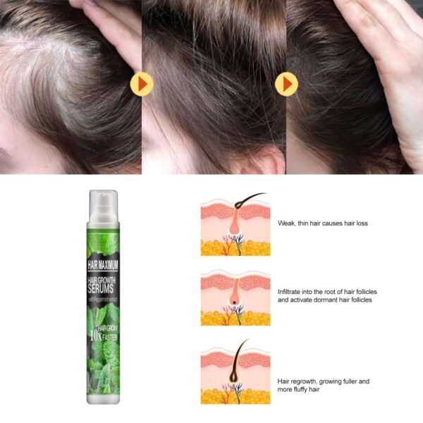 Hair Growth Spray Fast Grow Hair Oil Hair Loss Cure For Thinning Hair Products Hair Care 2