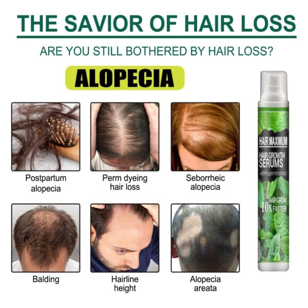 Hair Growth Spray Fast Grow Hair Oil Hair Loss Cure For Thinning Hair Products Hair Care 3