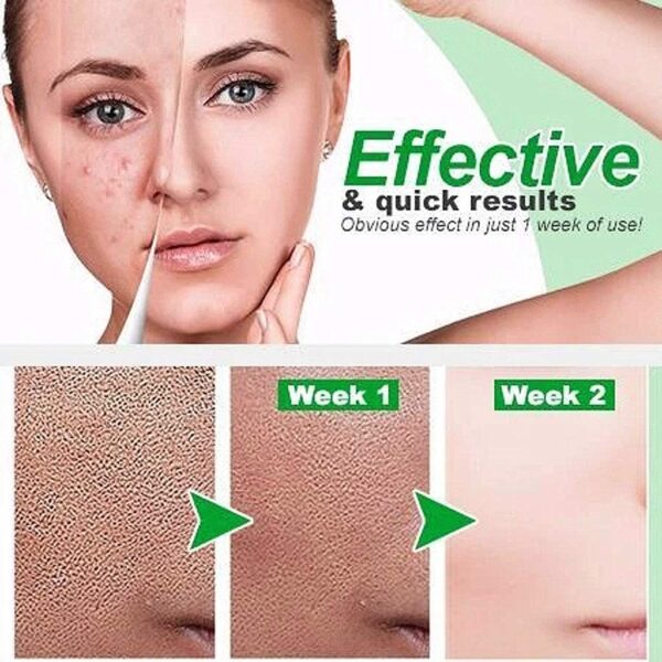 Zero pore Instant Perfection Serum Lactobionic Acid Face Solution Serum Minimize Pores Anti Wrinkle Lift Firming 5