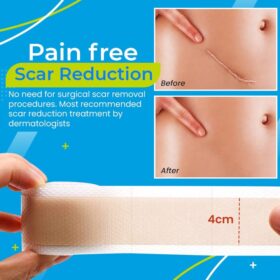 Scar Removal Gel Patch - image 5