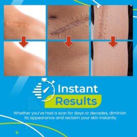 Scar Removal Gel Patch - image 2