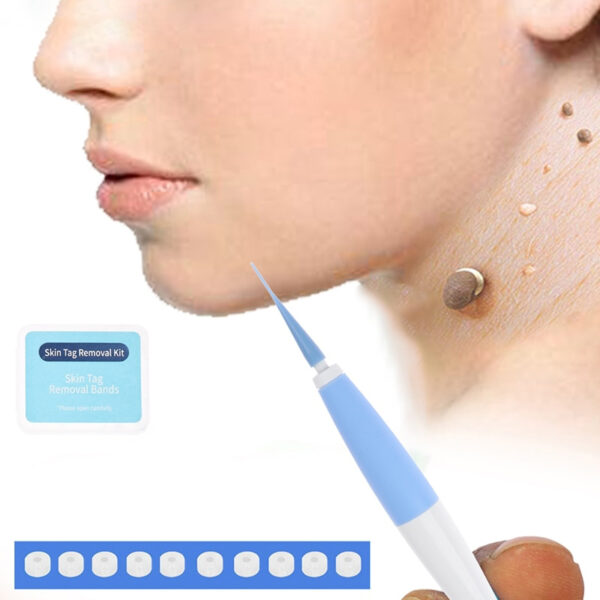 Skin Tag Remover To Remover Wart Spot Remover Mole Remover Skin Care Warts Removal Medium Skin 6