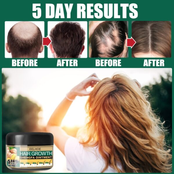1 Pcs Hair Growth Products Fast Growing Hair Oil Hair Loss Care Cream Beauty Hair Scalp 2