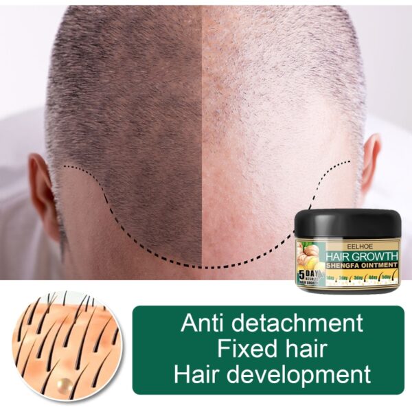1 Pcs Hair Growth Products Fast Growing Hair Oil Hair Loss Care Cream Beauty Hair Scalp