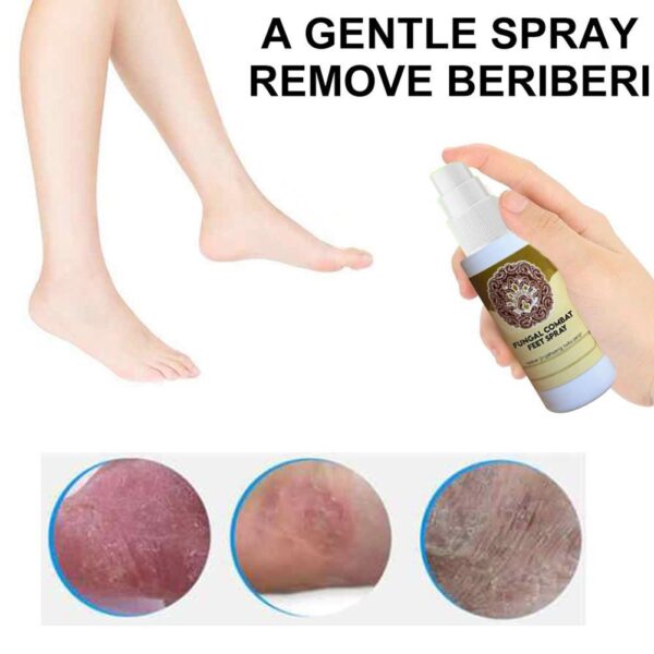 Fungal Combat Feet Spray Foot Sterilize Spray Herbal Anti fungal Infection Toe Treatment Onychomycosis Anti Bacterial 2