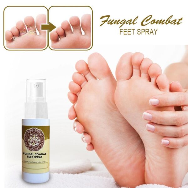 Fungal Combat Feet Spray Foot Sterilize Spray Herbal Anti fungal Infection Toe Treatment Onychomycosis Anti Bacterial