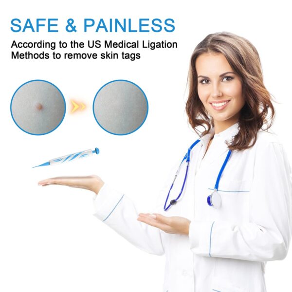 Skin Tag Removal Kit Home Use Mole Wart Remover Equipment Micro Skin Tag Treatment Tool Easy 1