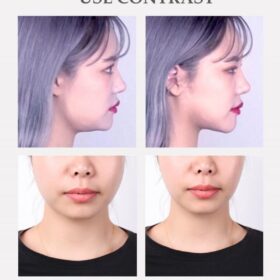 Invisible Face Filter Tape - image 5