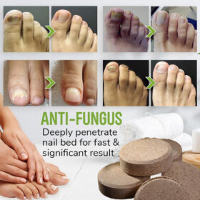 Anti-fungal Foot Soak - image 4