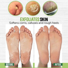 Anti-fungal Foot Soak - image 5