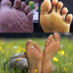 Anti-fungal Foot Soak - image 6