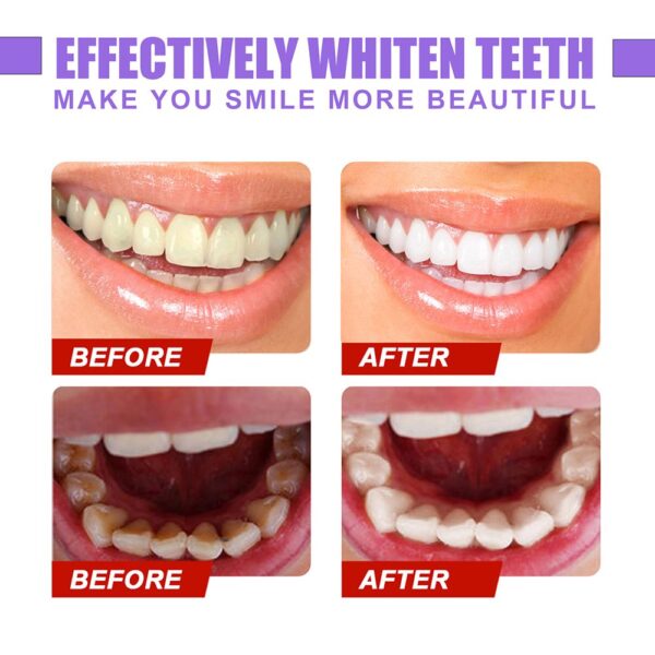 Remove Plaque Stains Care Toothpaste V34 Colour Corrector Teeth Mouth Breathing Freshener Whitening Sensitive Teeth Toothpaste 3